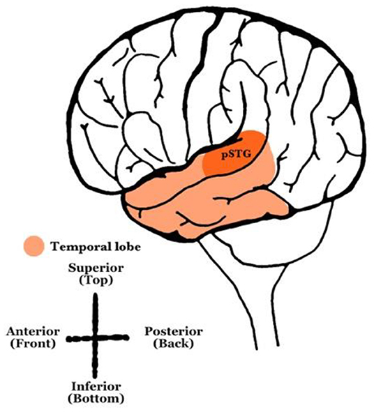 Figure 1 - Surface view of the left side of the brain, with the temporal lobe highlighted in light orange and the posterior superior temporal gyrus highlighted in dark orange.