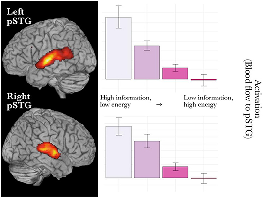 Figure 2 - Areas that responded more to talking in noise (compared to just listening).