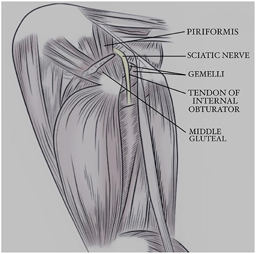 superior gluteal nerve injection