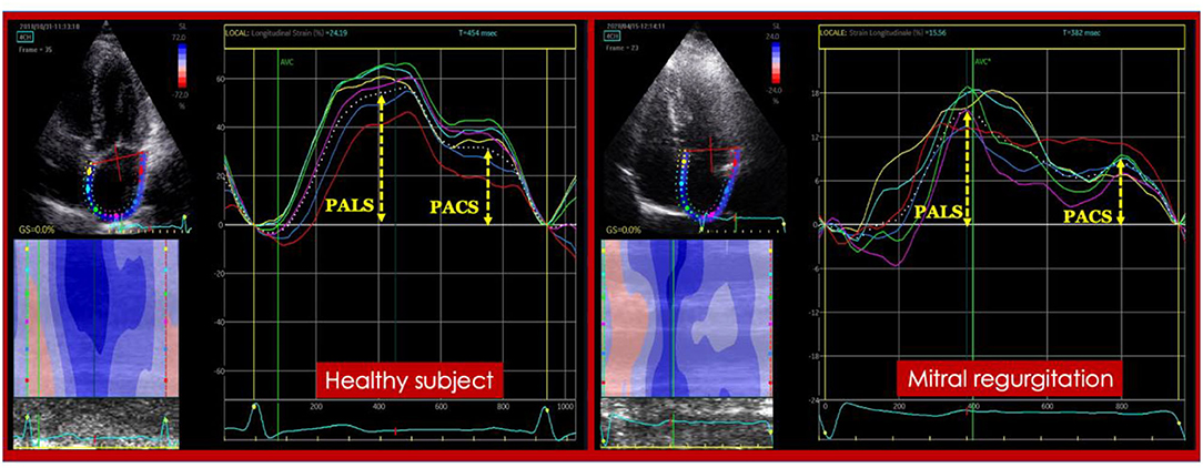 A method for direct estimation of left ventricular global longitudinal  strain rate from echocardiograms