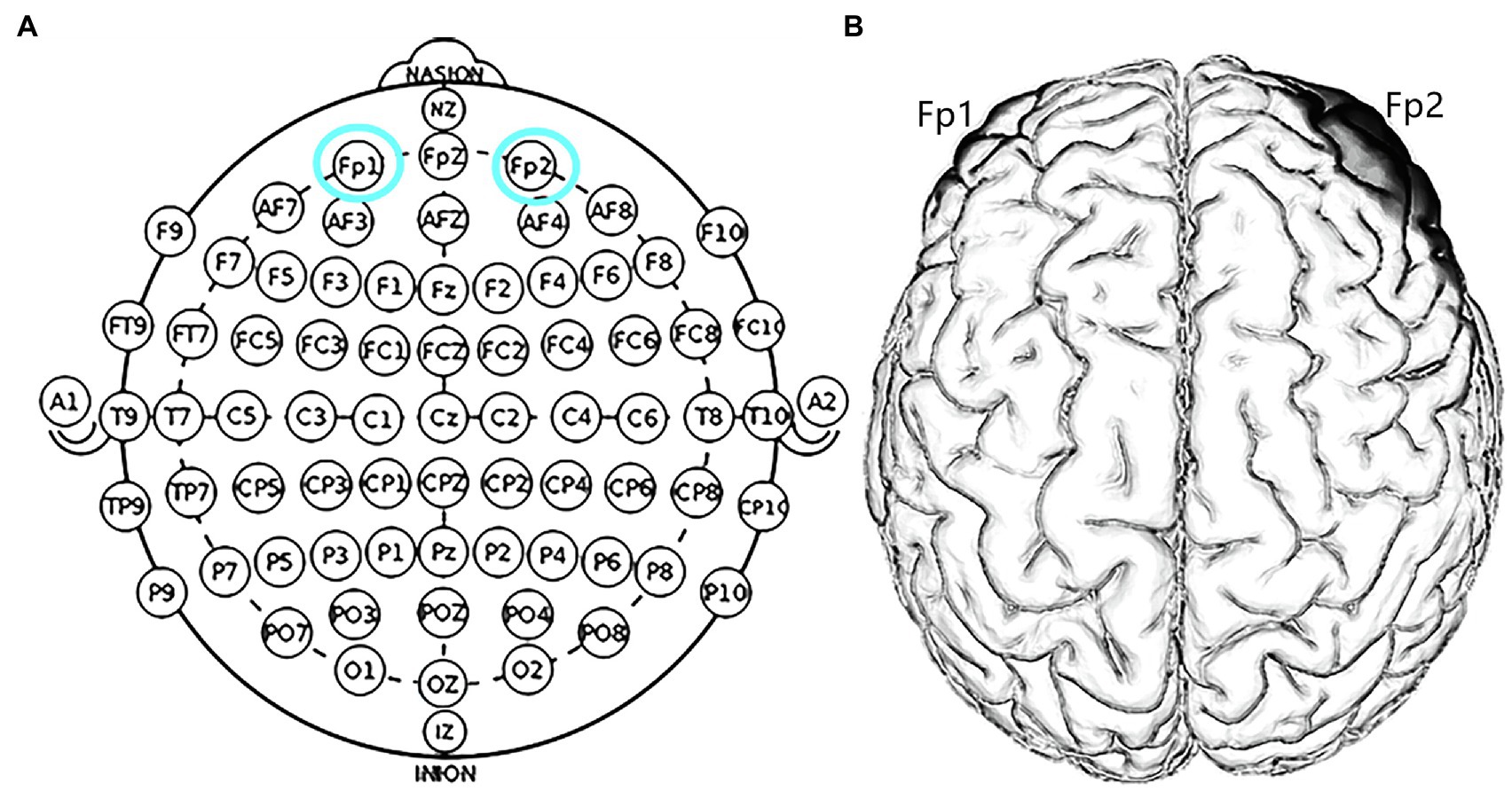 Frontiers  Modulating OFC Activity With tDCS Alters Regret About Human  Decision-Making