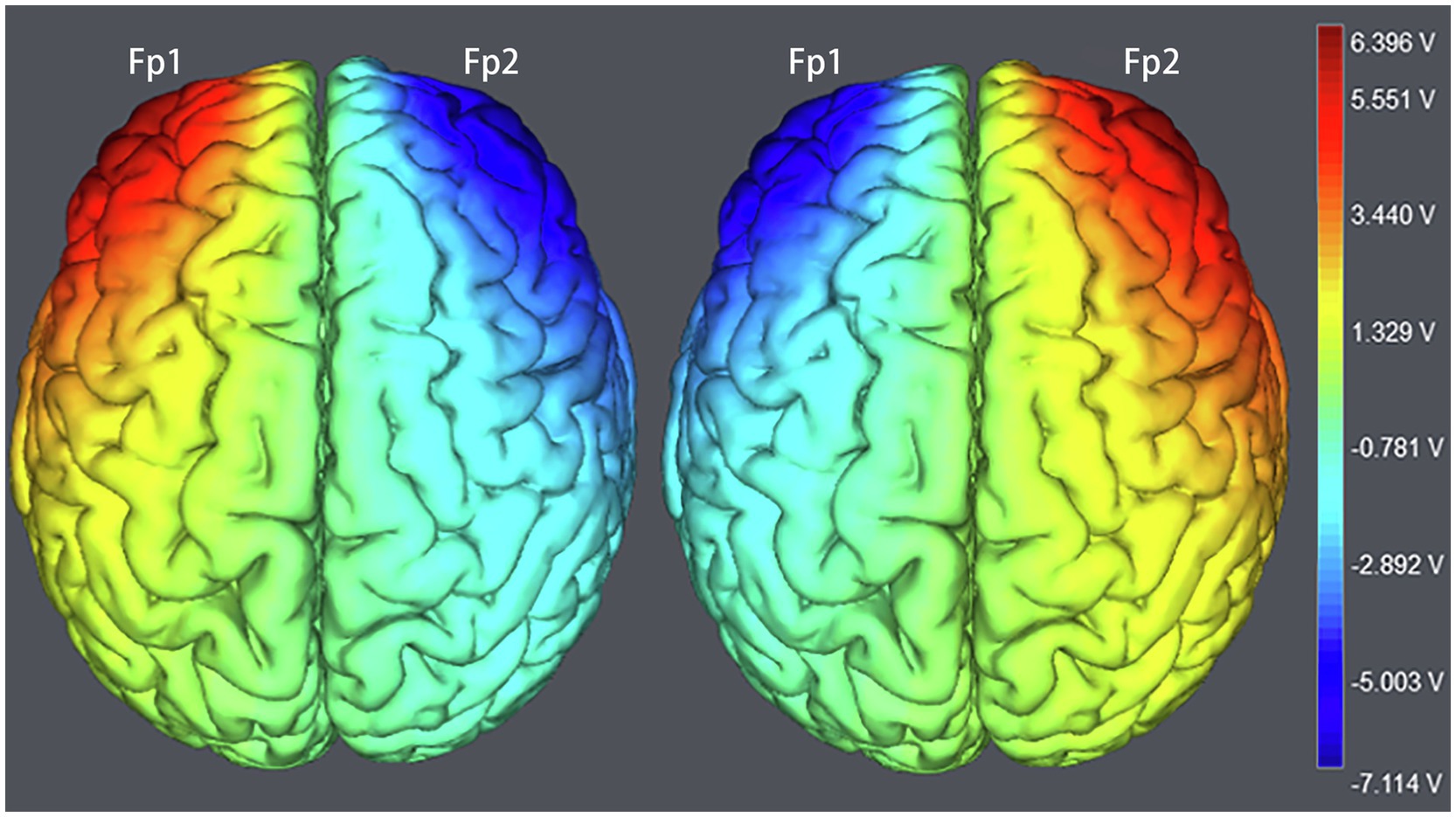 Frontiers  Modulating OFC Activity With tDCS Alters Regret About Human  Decision-Making