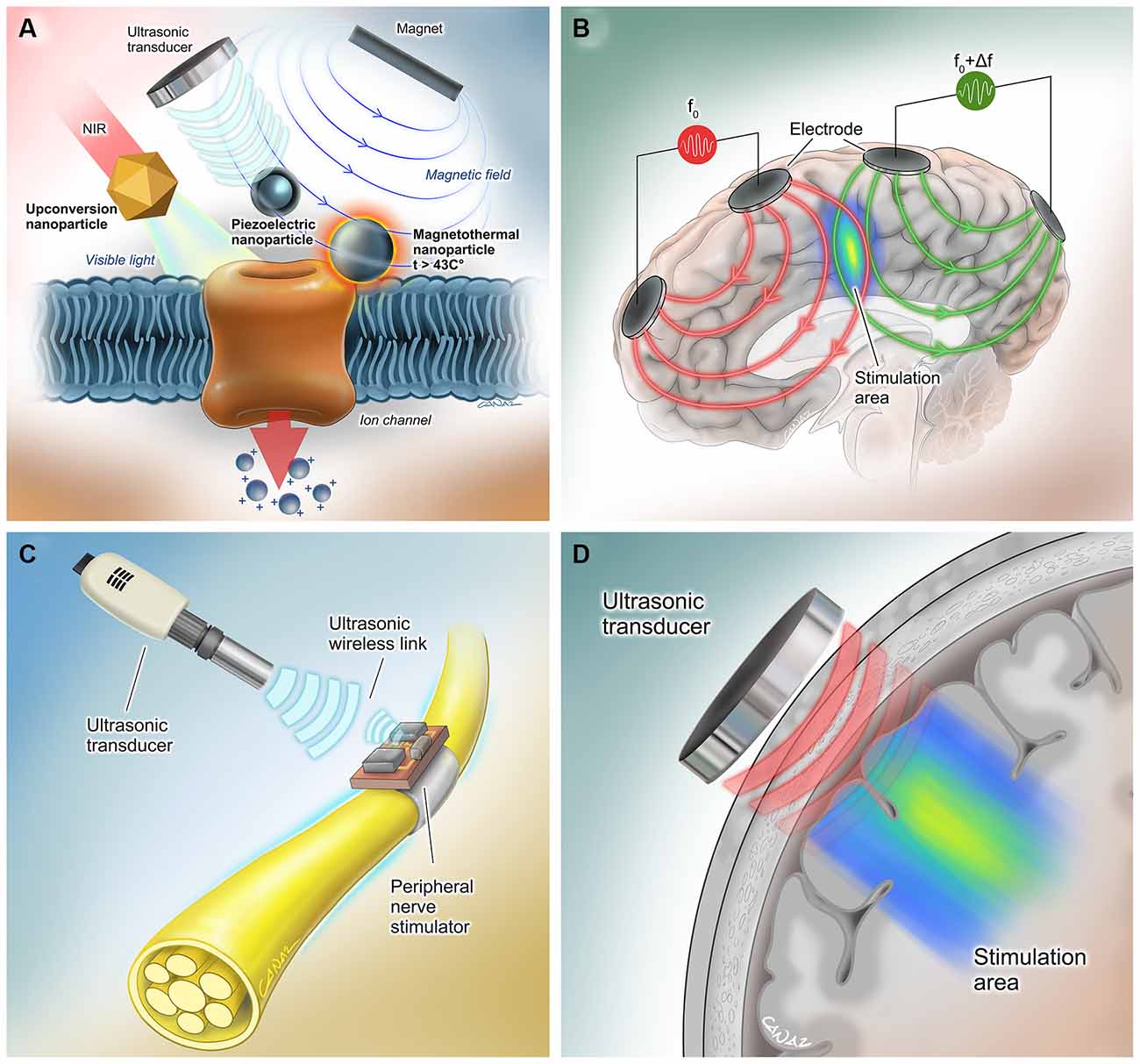 Boston Scientific Spinal Cord Stimulator Review: Disadvantages And Risks Of  The Surgery Implant