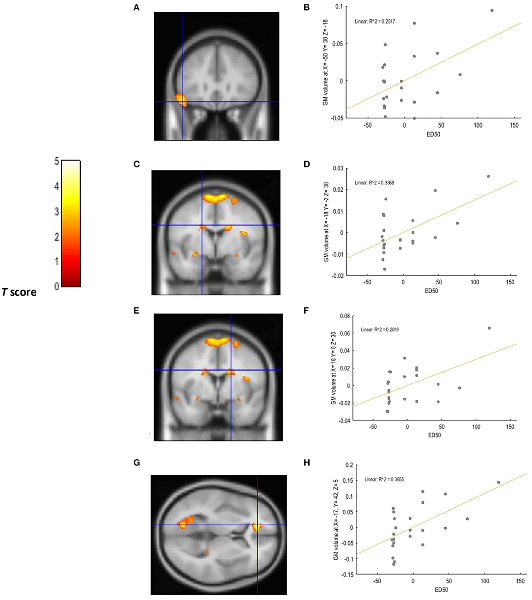 Frontiers | Neuroanatomical of Impulsive Choices and Risky Decision Making in Young Chronic Tobacco Smokers: A Voxel-Based Study Psychiatry