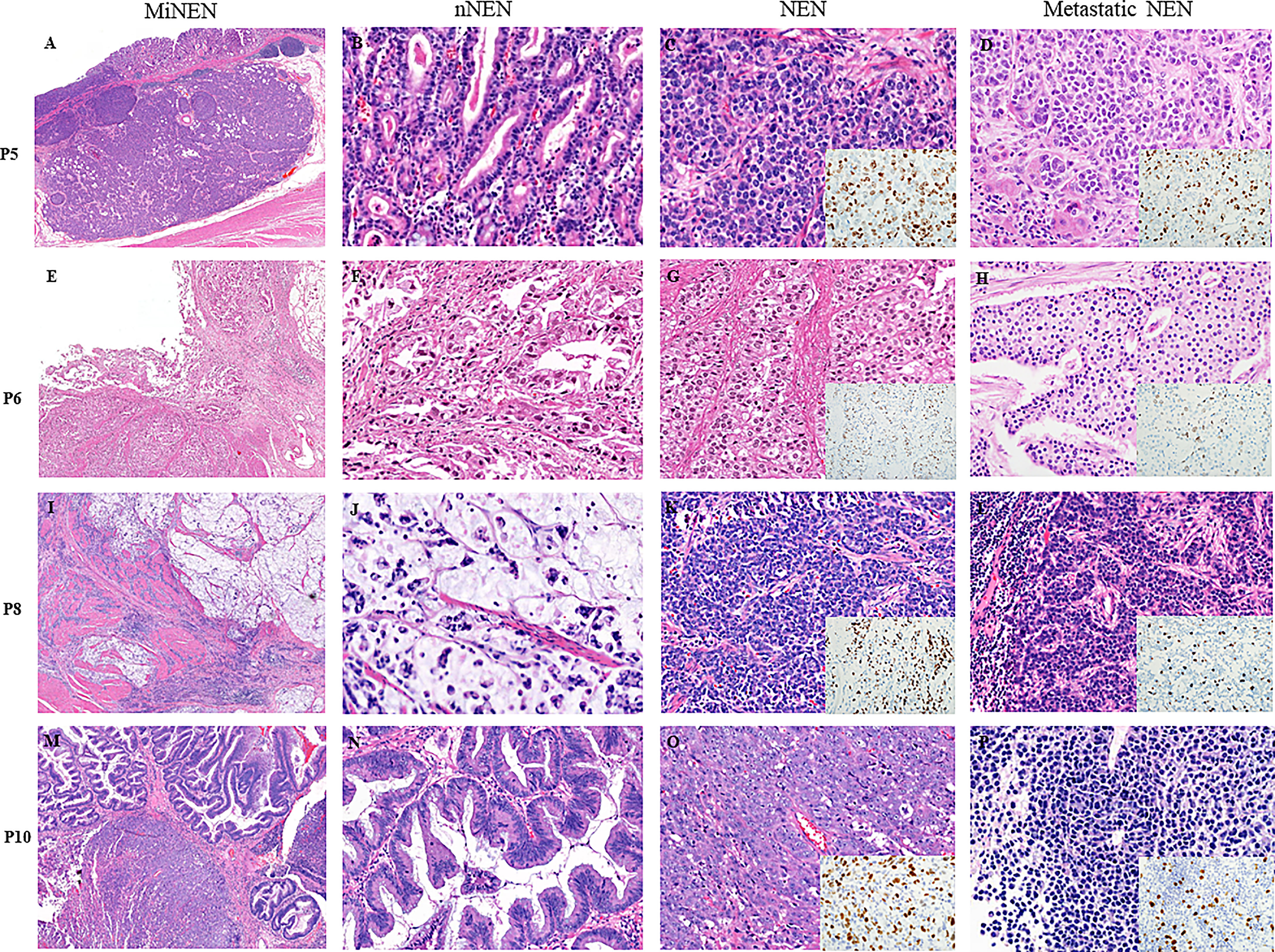 A-D Four representative cases of different breast size and parenchymal