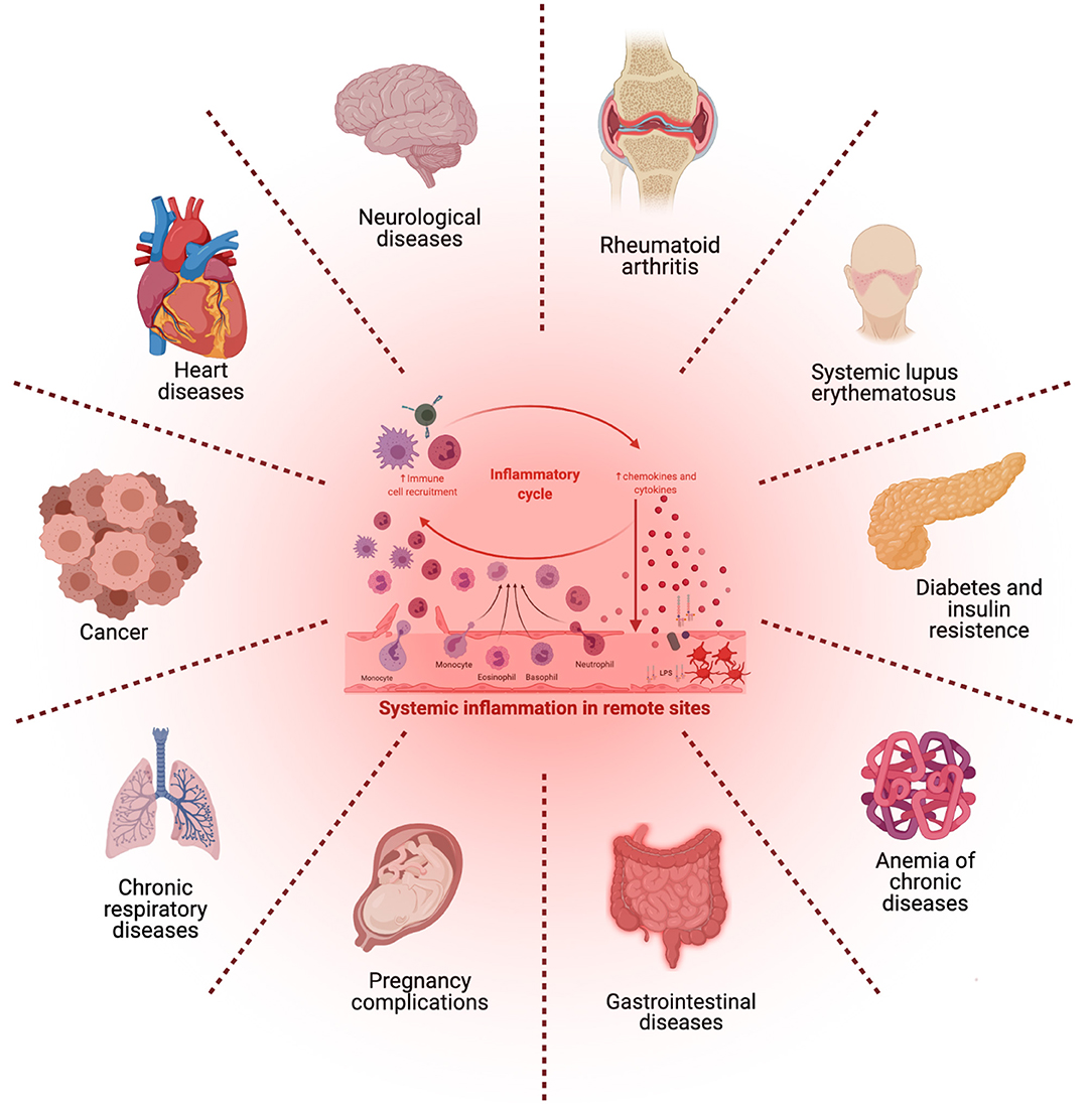 Frontiers Periodontal Inflammation And Systemic Diseases An Overview