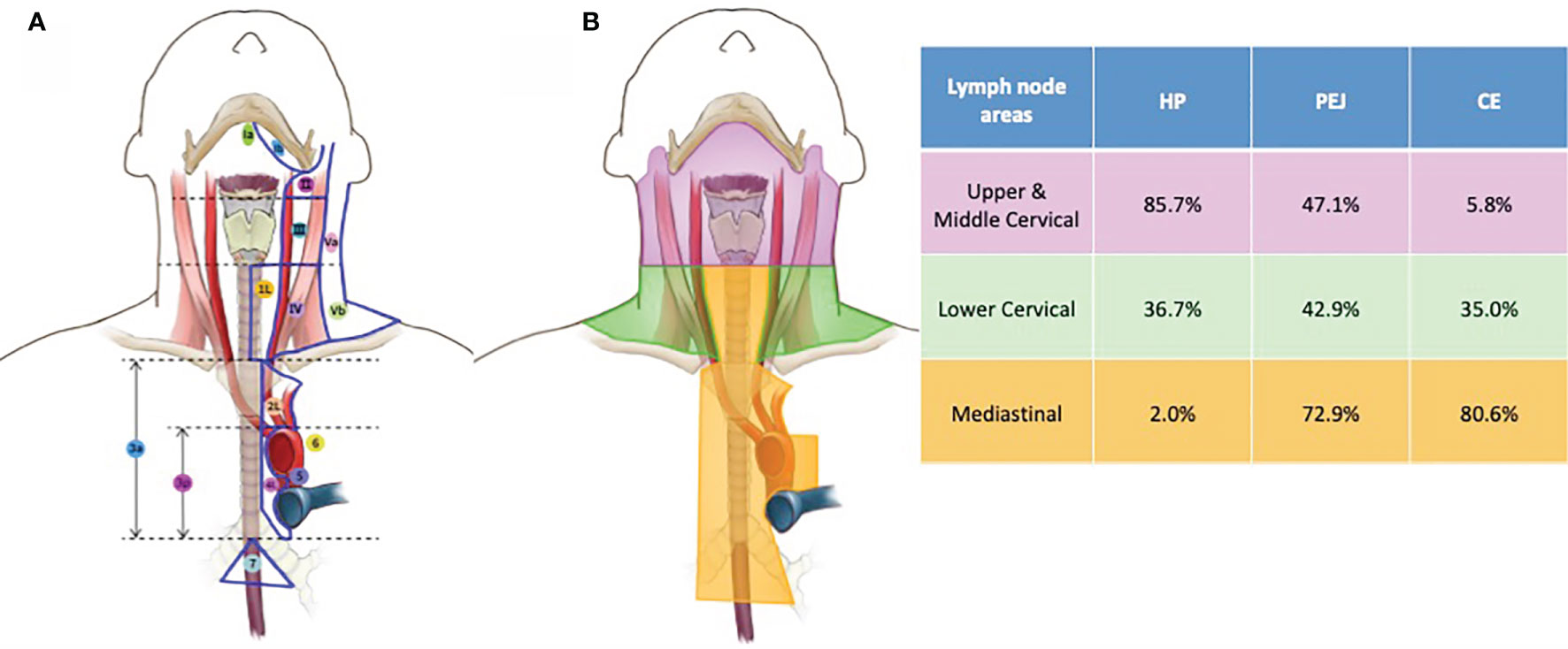 Periesophageal Lymph Nodes