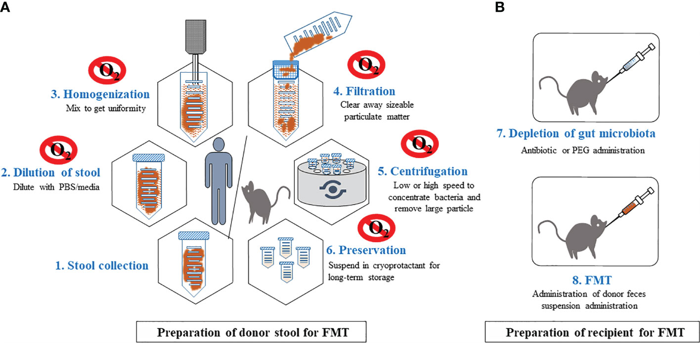 Q&A: DIY fecal microbiota transplantation a risky game of 'Russian roulette