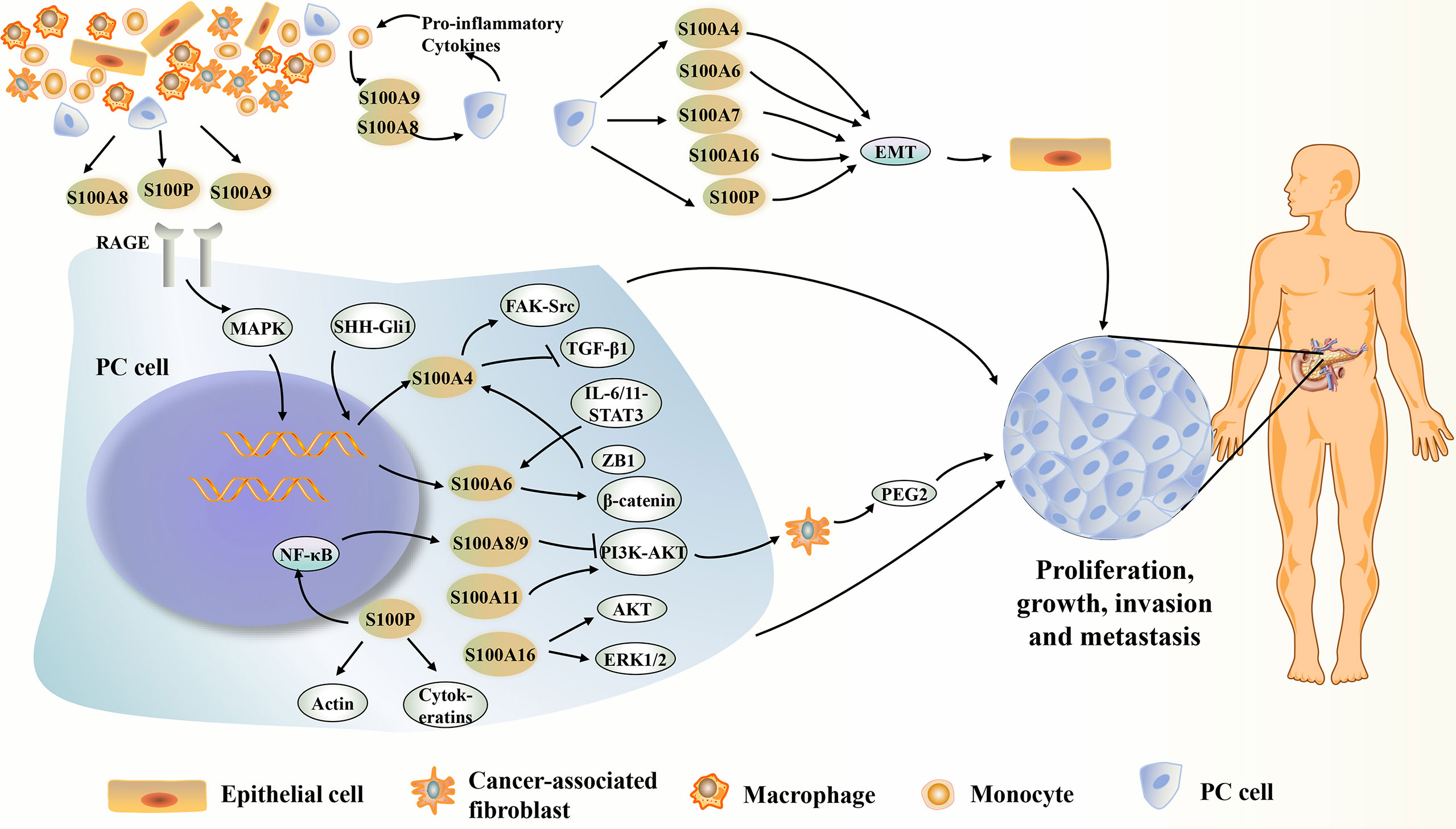 | S100 Proteins in Pancreatic Cancer: Current and Future Perspectives
