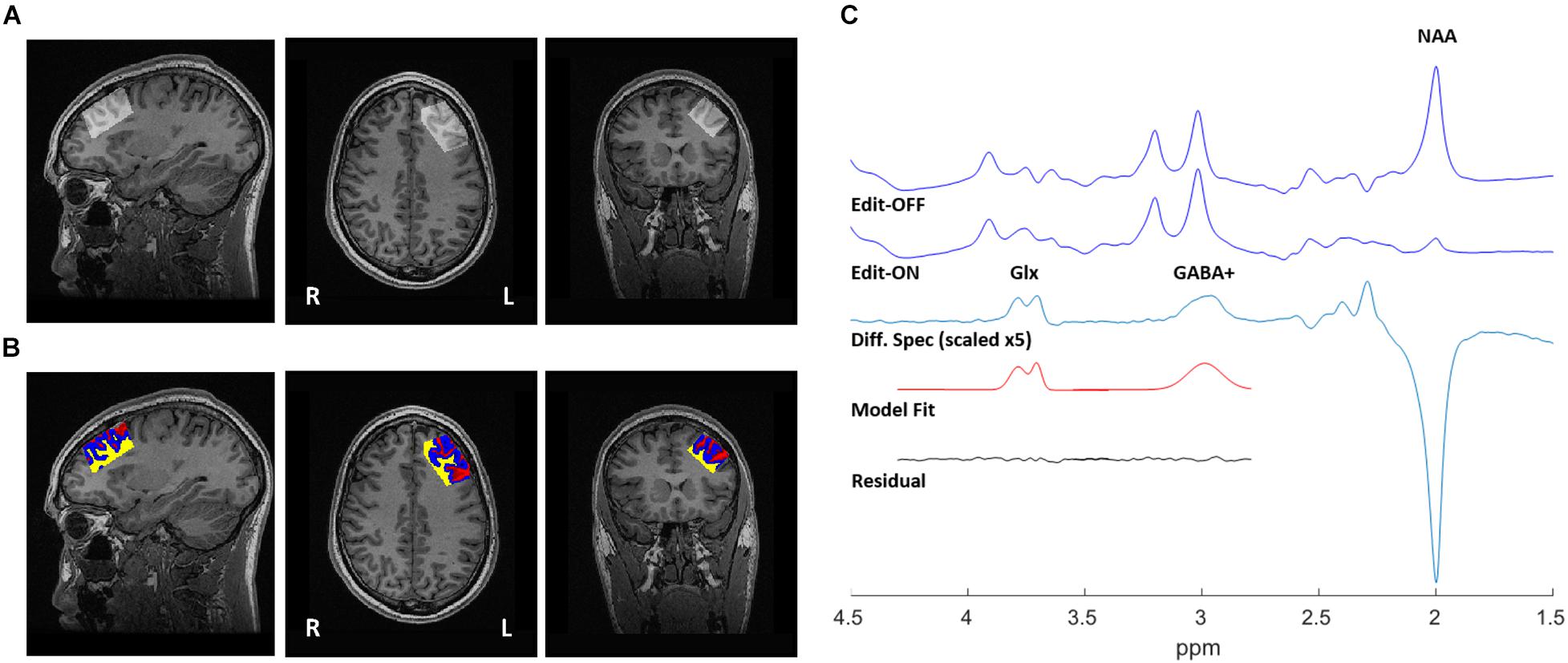 Glutamate - The Autism Community in Action