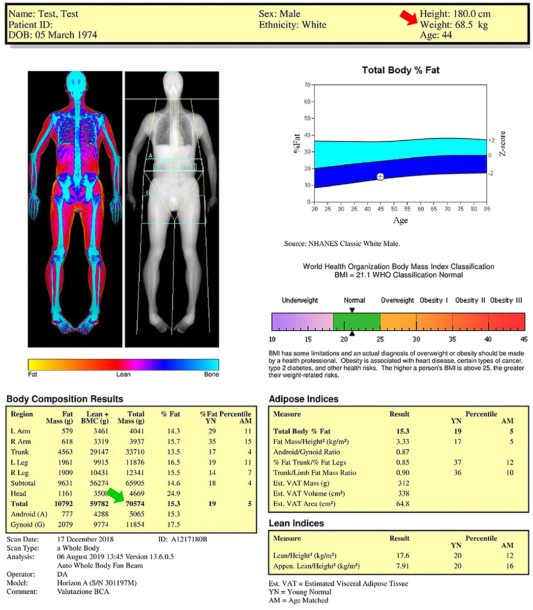 Zone Body Fat Calculator: Measure Lean Body Mass & Fat Weight