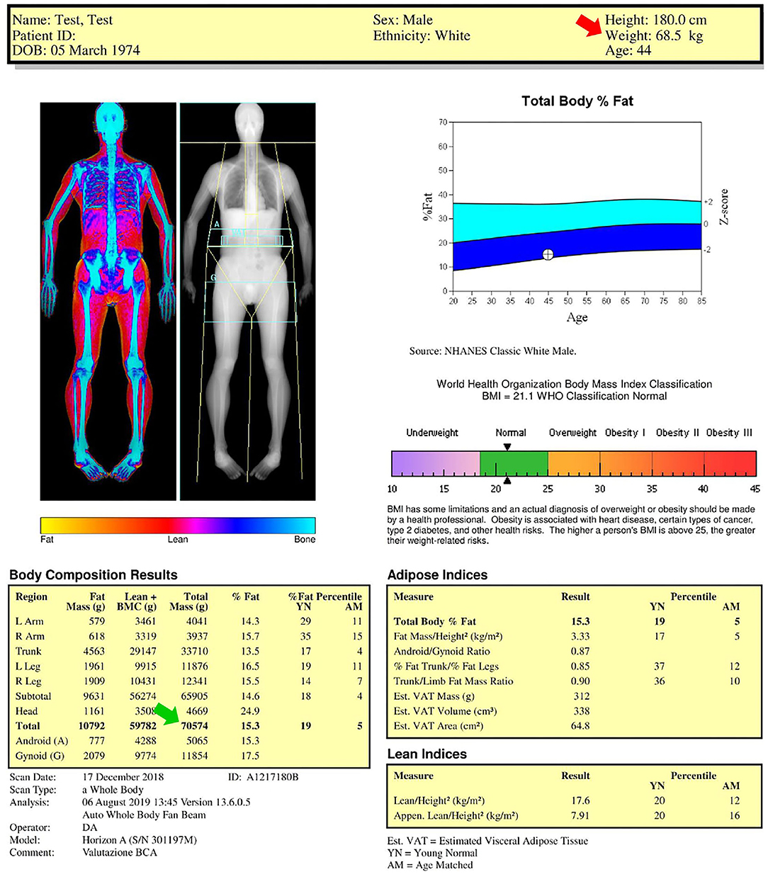 Percentile scale for body fat percentage in relation to age