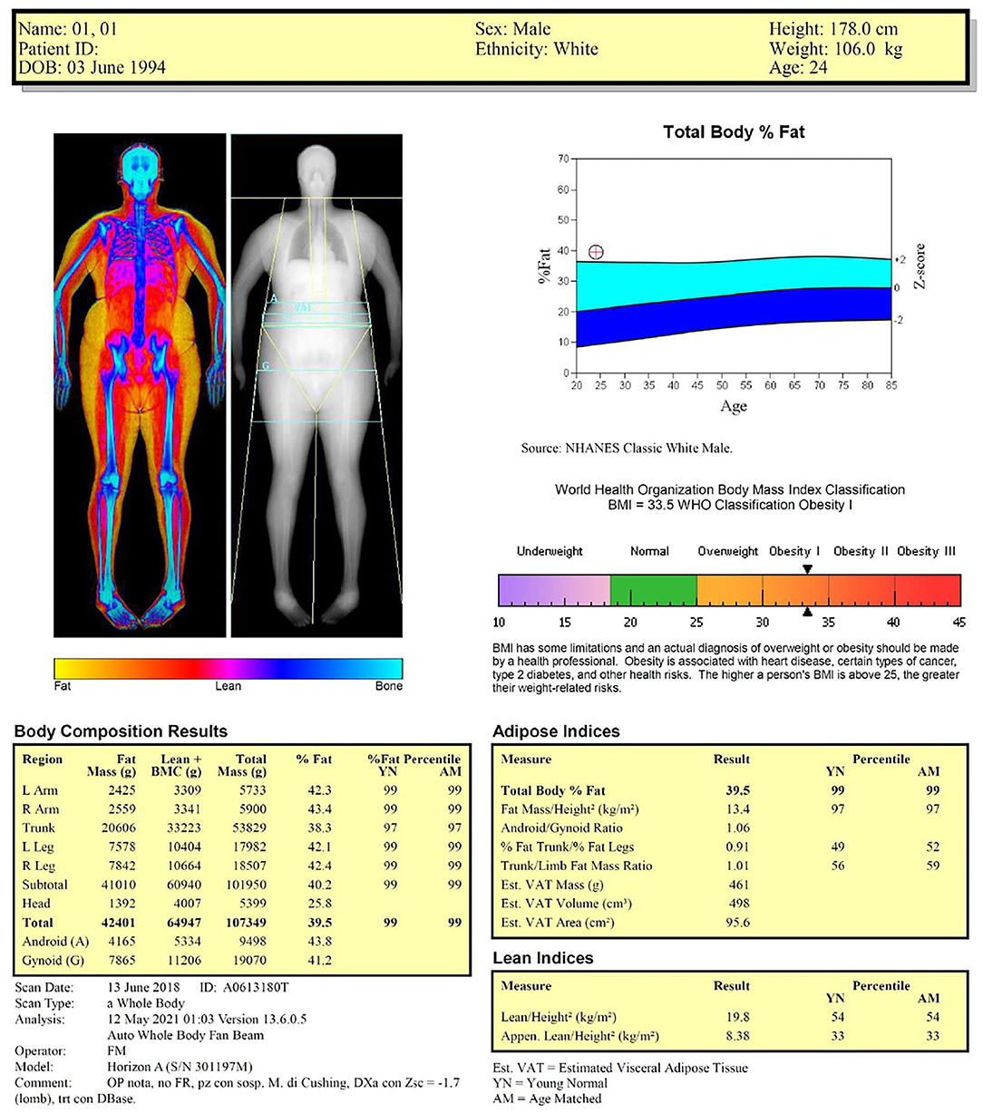 DEXA Scan Orlando, DEXA Scans in Orlando, FL