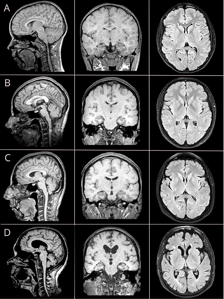 Journal of Magnetic Resonance Imaging: Vol 55, No 1