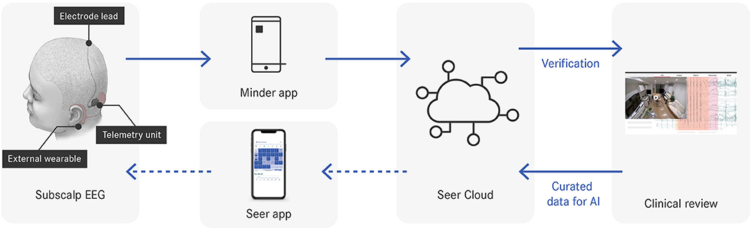 Frontiers  Seizure Forecasting Using a Novel Sub-Scalp Ultra-Long Term EEG  Monitoring System