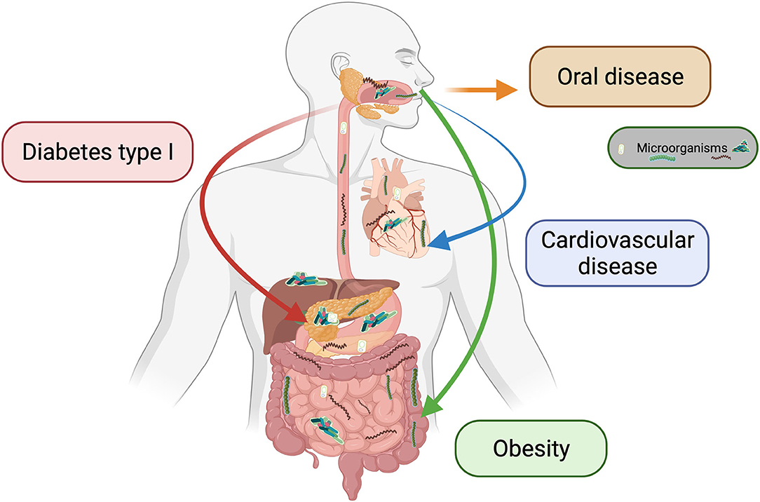 Frontiers Exploring The Interplay Between Oral Diseases Microbiome 