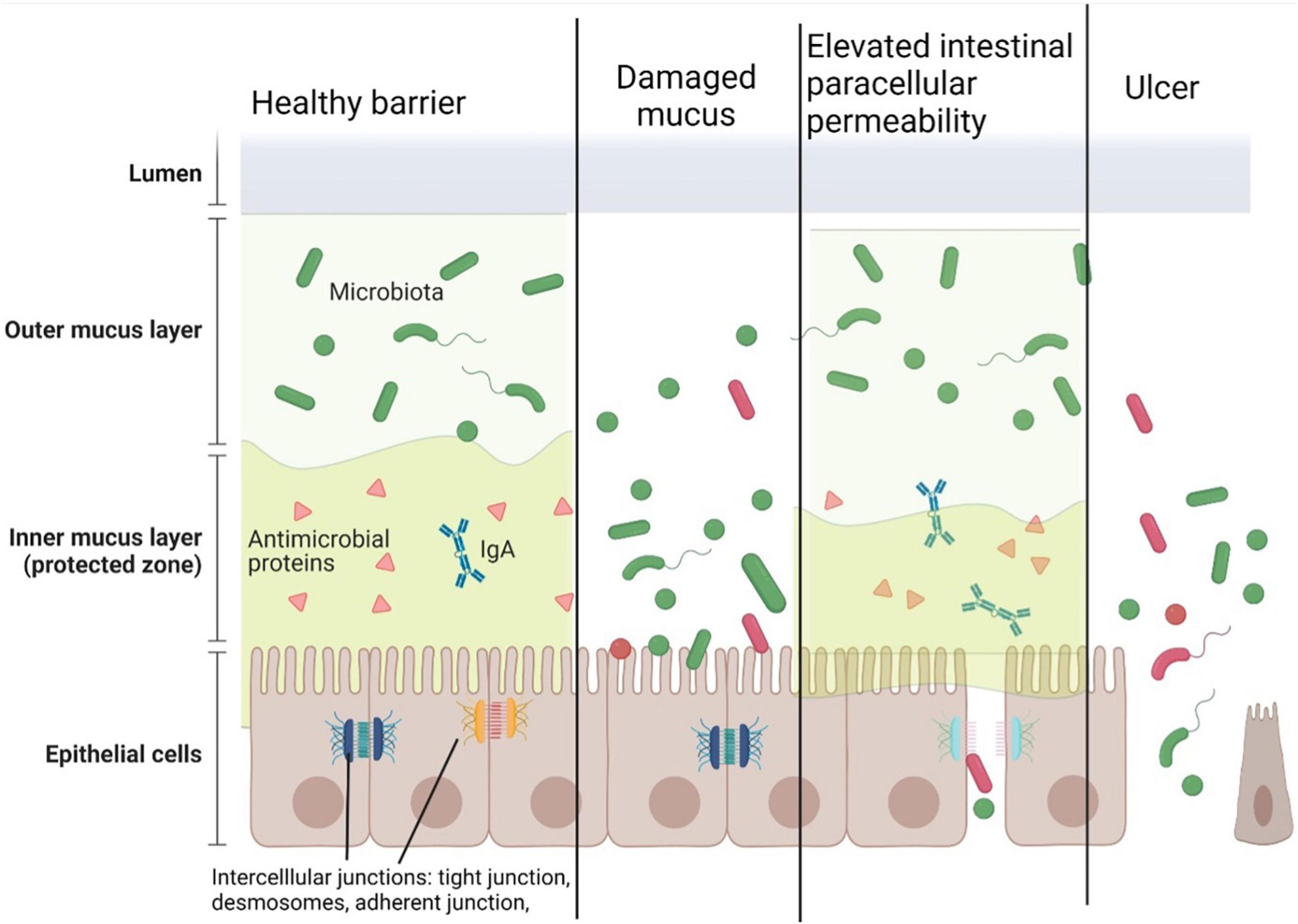 Frontiers The Influence of Nutrition on Intestinal Permeability and the Microbiome in Health and Disease