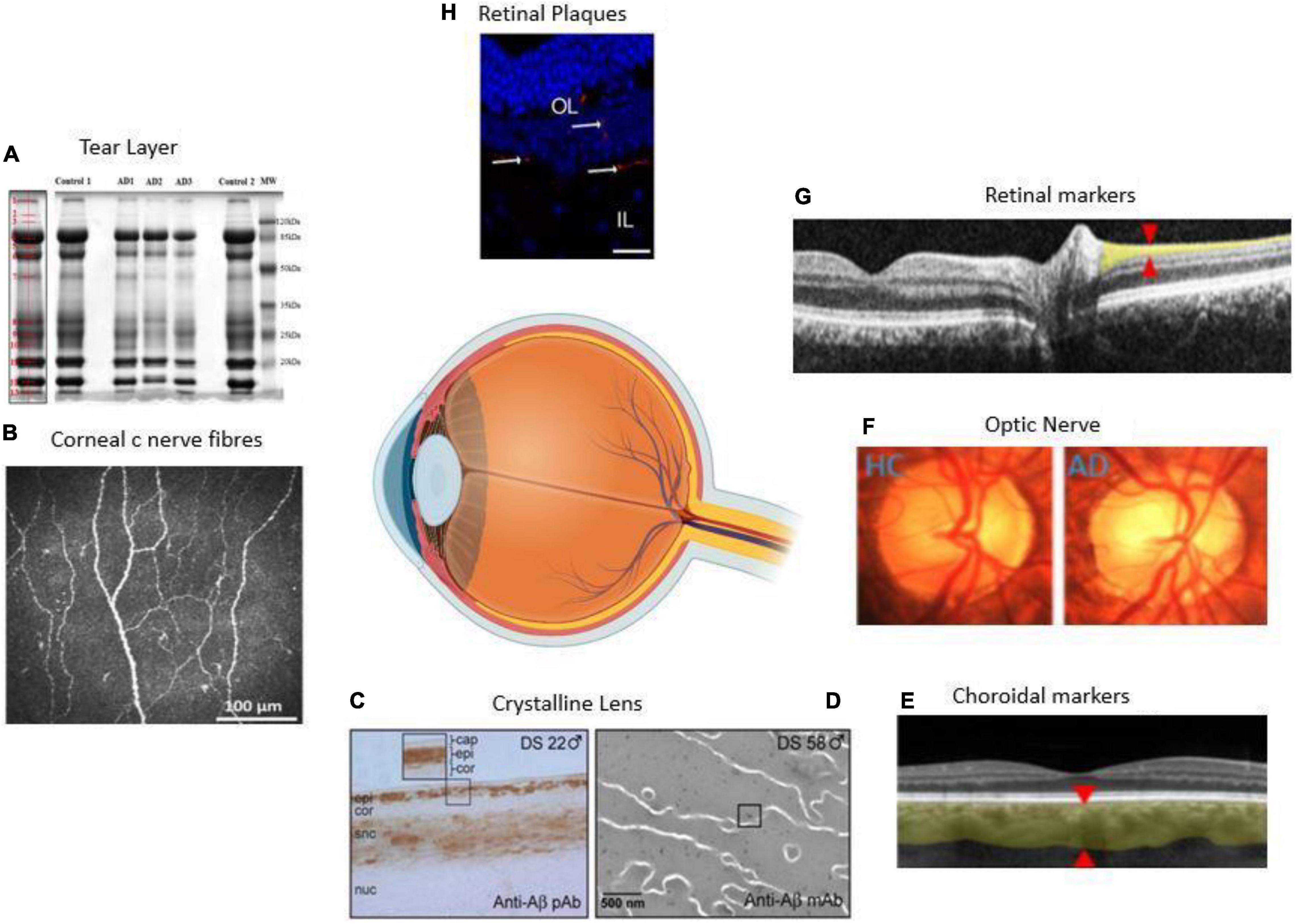 PDF) Blood Biomarkers of Alzheimer's Disease and Cognition: A Literature  Review.