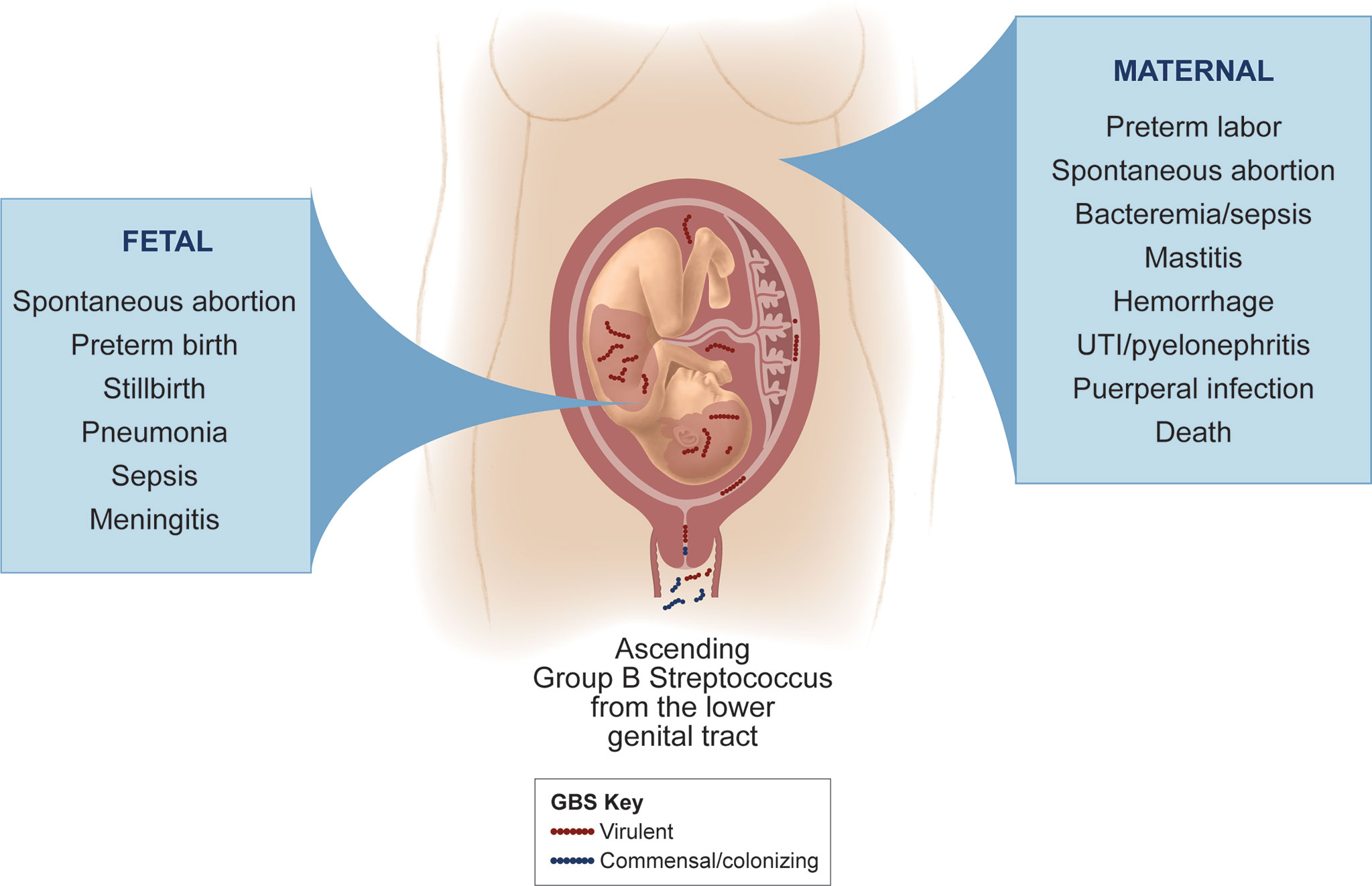 Frontiers Bacterial And Host Determinants Of Group B Streptococcal Vaginal Colonization And Ascending Infection In Pregnancy Cellular And Infection Microbiology