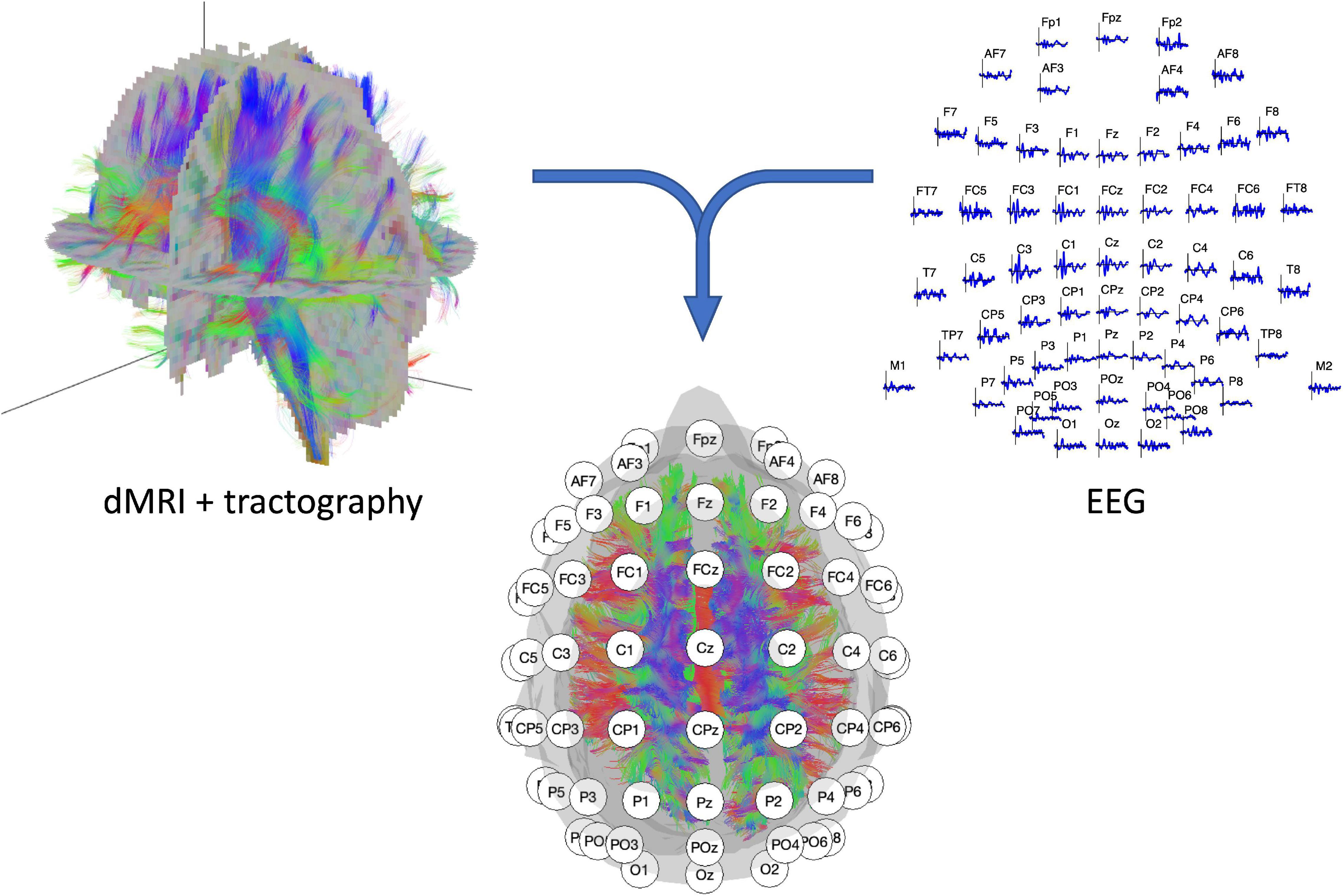 Large-scale functional brain networks in human non-rapid eye movement  sleep: insights from combined electroencephalographic/functional magnetic  resonance imaging studies