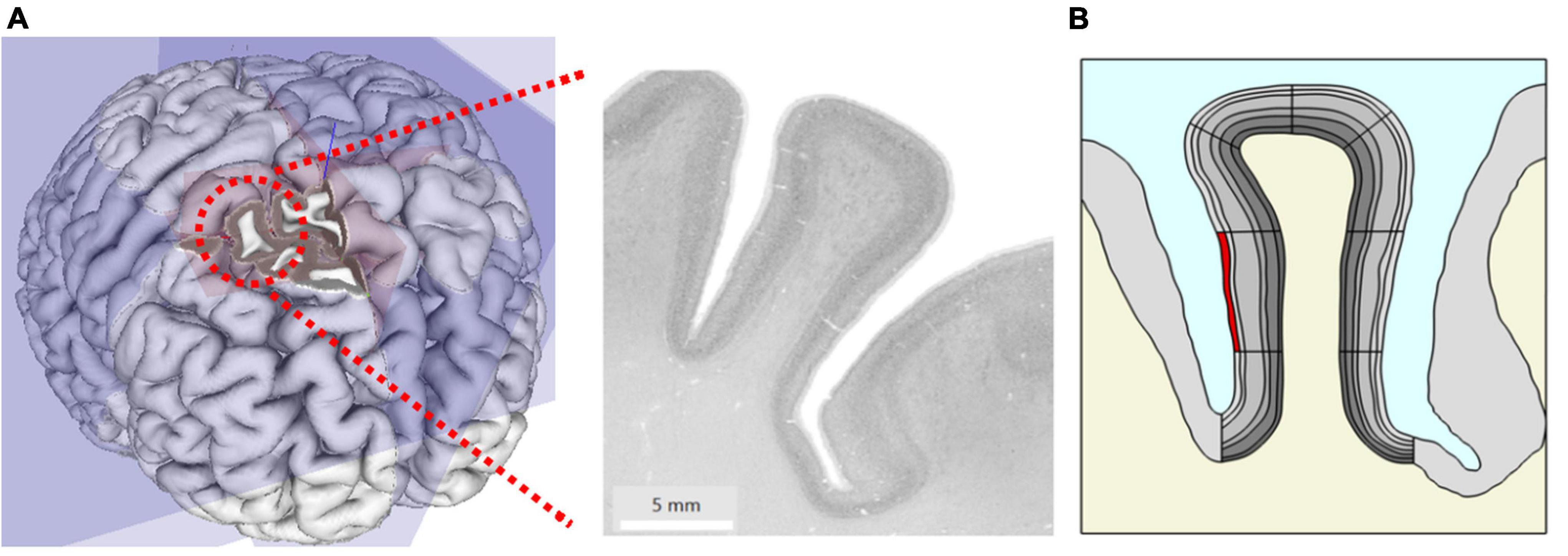 BigBrain: An Ultrahigh-Resolution 3D Human Brain Model