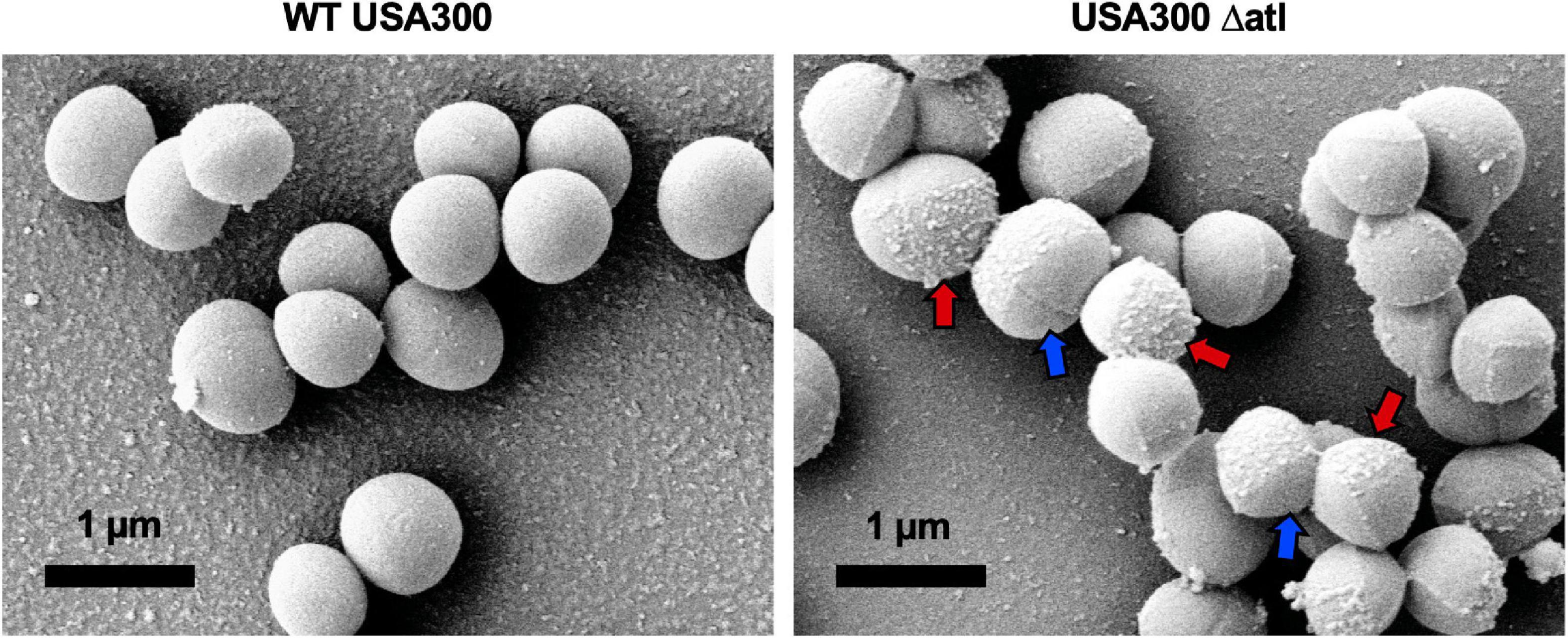 Frontiers  Staphylococcus aureus Cell Wall Biosynthesis Modulates Bone  Invasion and Osteomyelitis Pathogenesis