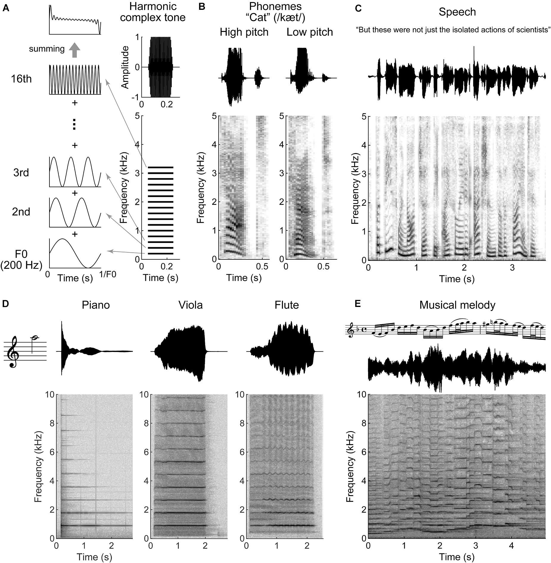 Frontiers  Lemniscal Corticothalamic Feedback in Auditory Scene