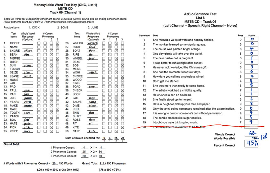 PDF) Assessing Variability in Pronunciation Development: Case