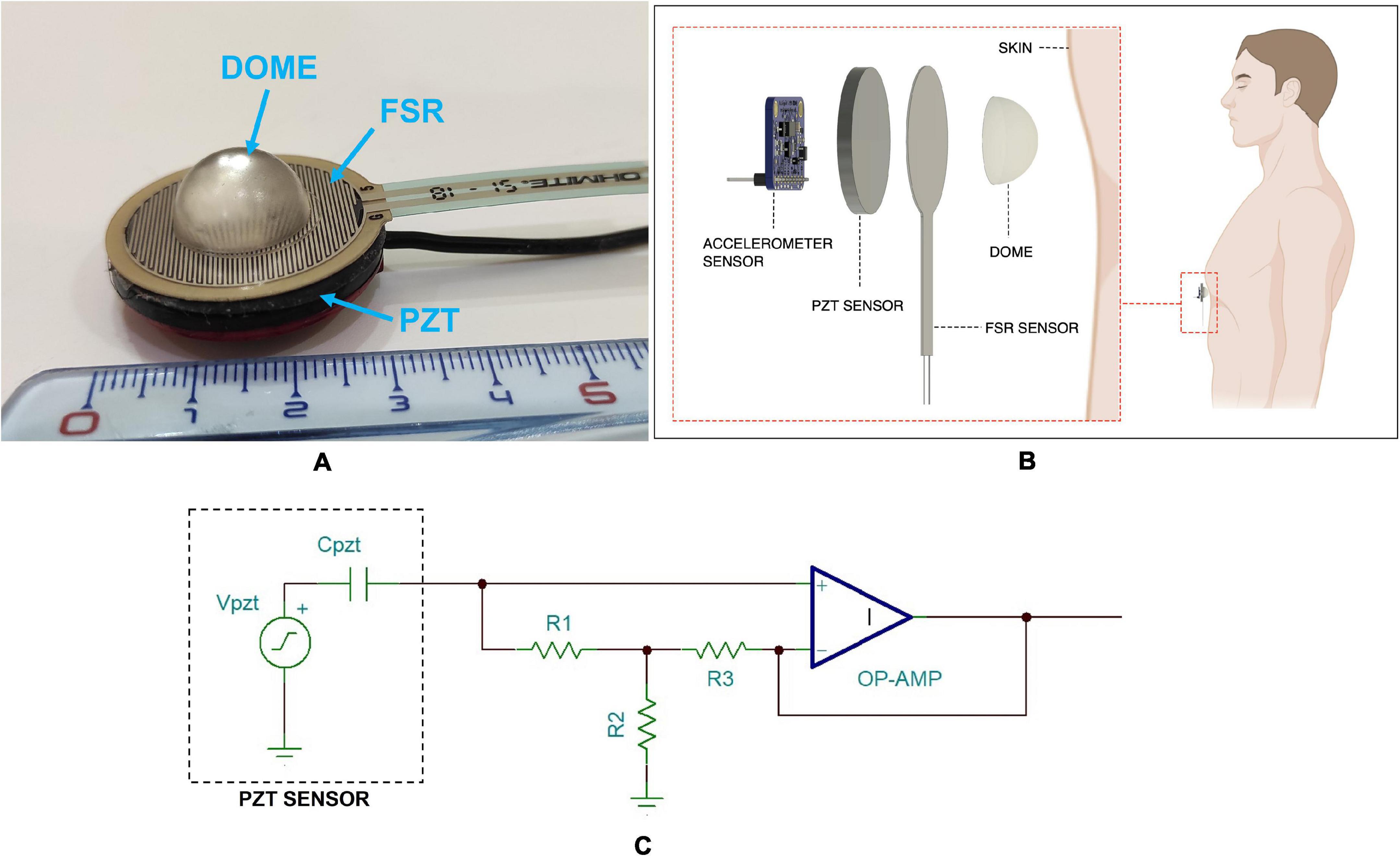 Belt with sensors monitors heart parameters 24/7 - Today's Medical  Developments