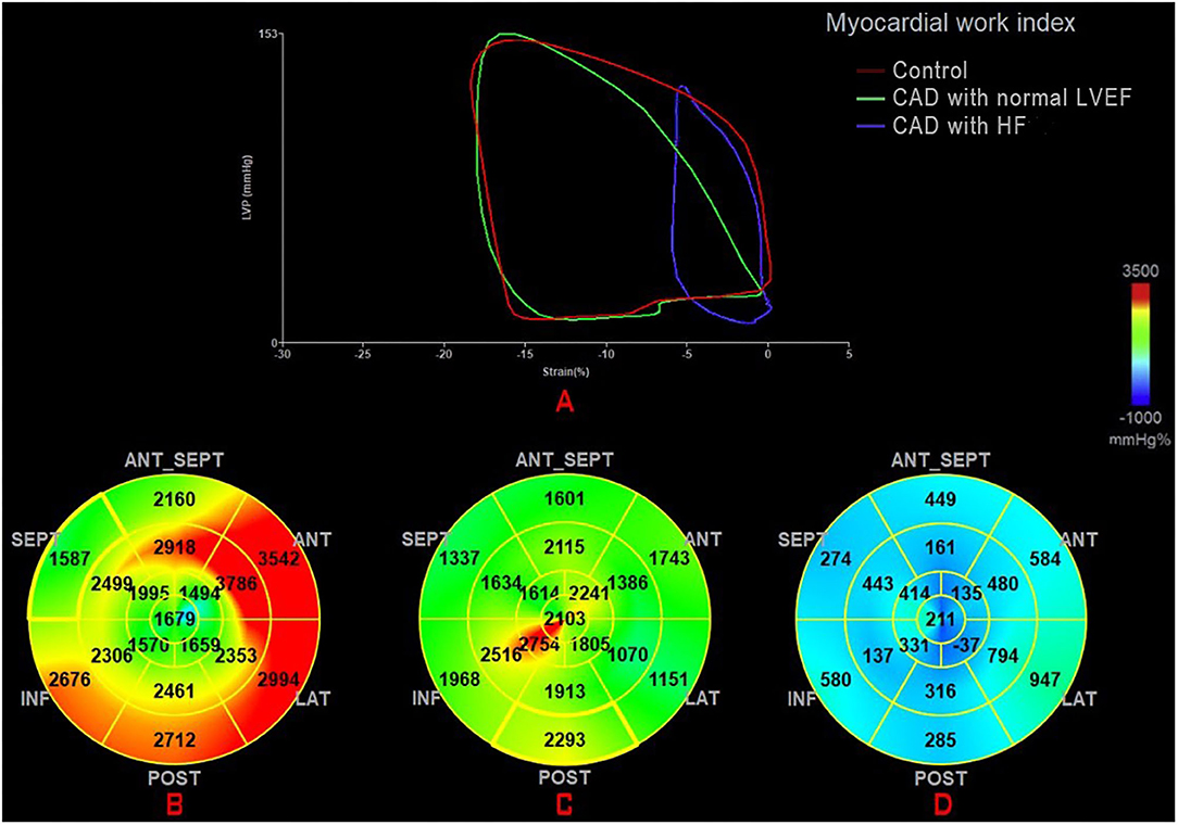 Myocardial global longitudinal strain: An early indicator of