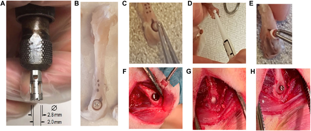 Surgical Glue Dressing Usage During Post-Frenectomy Second Intention Wound  Healing - Jenny Chang DMD, DMSc - American Laser Study Club