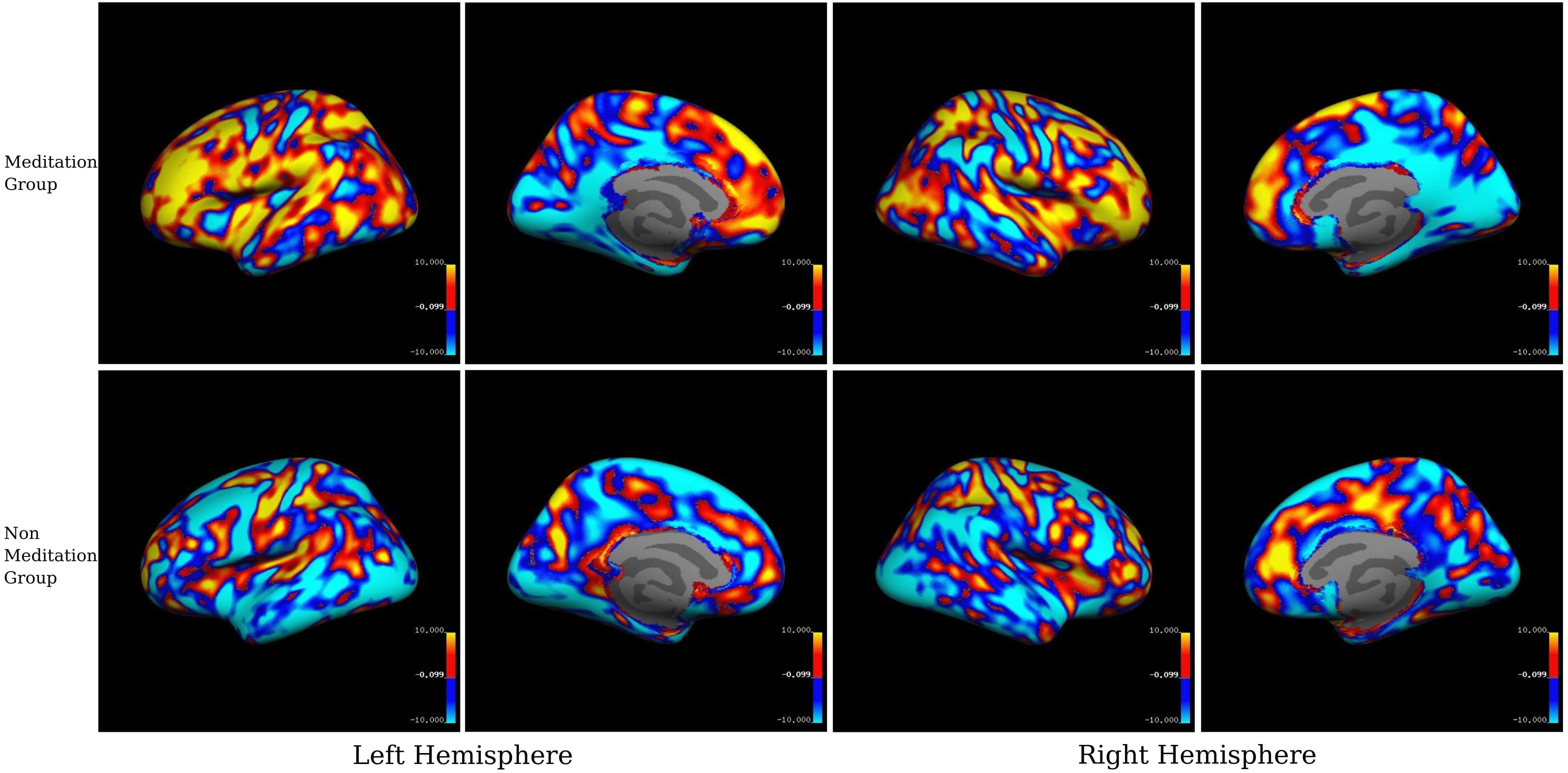 Impacts of Meditation on Brain