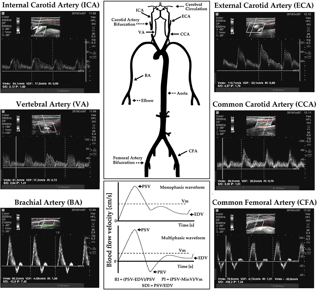 Eco Doppler exams - Duplex Ultrasound - DentQ International