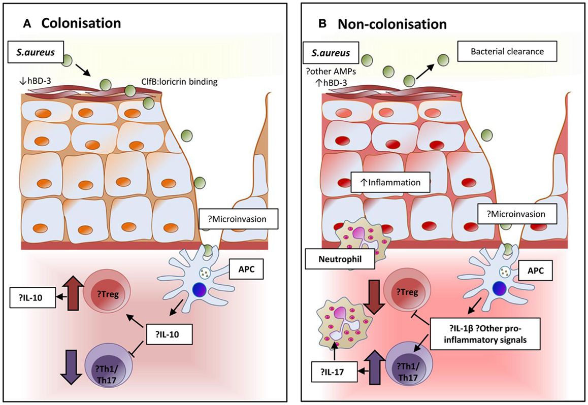 The role of nasal carriage in Staphylococcus aureus infections - The Lancet  Infectious Diseases