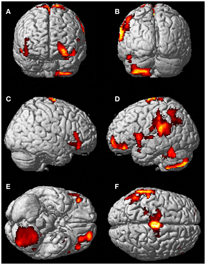 Frontiers  Voluntary Out-of-Body Experience: An fMRI Study