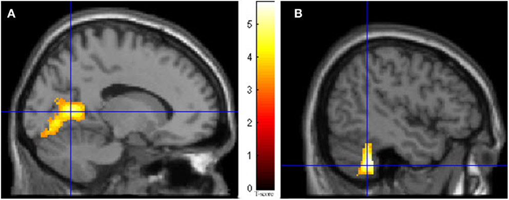 Frontiers  Voluntary Out-of-Body Experience: An fMRI Study