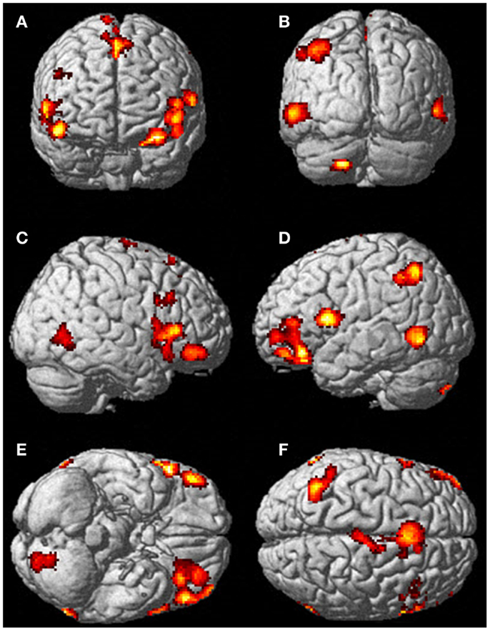 Frontiers  Voluntary Out-of-Body Experience: An fMRI Study