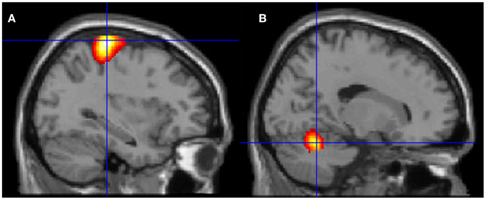 Frontiers  Voluntary Out-of-Body Experience: An fMRI Study