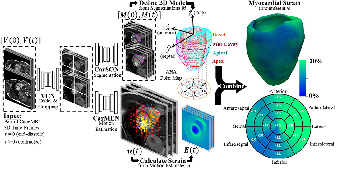 Myocardial Deformation Imaging