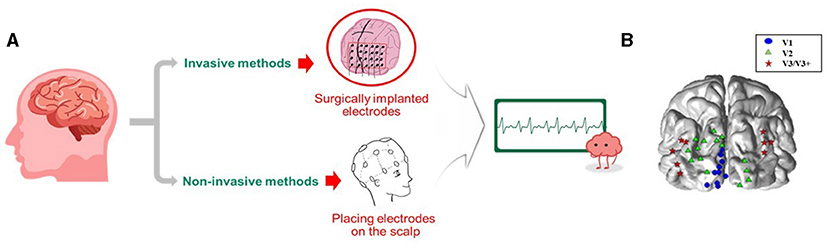 Figure 2 - (A) To detect electrical signals in the brain, electrodes can either be placed on the scalp or implanted into the brain during surgery.