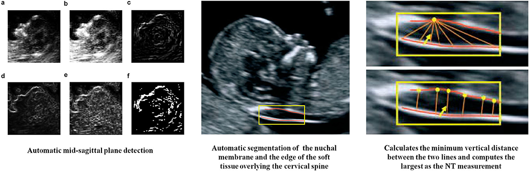 Advanced OB/GYN Ultrasound Applications