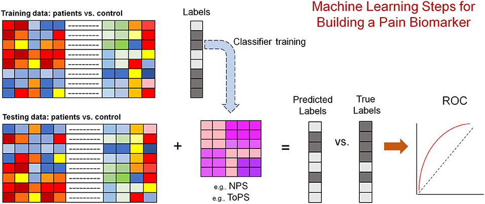 Genome-wide association study of nociceptive musculoskeletal pain treatment  response in UK Biobank