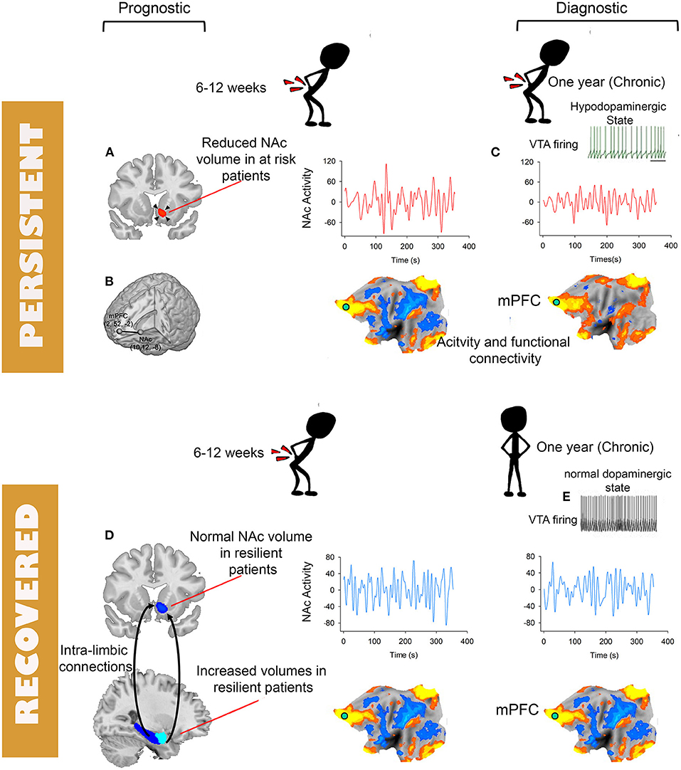 Brain imaging tests for chronic pain: medical, legal and ethical