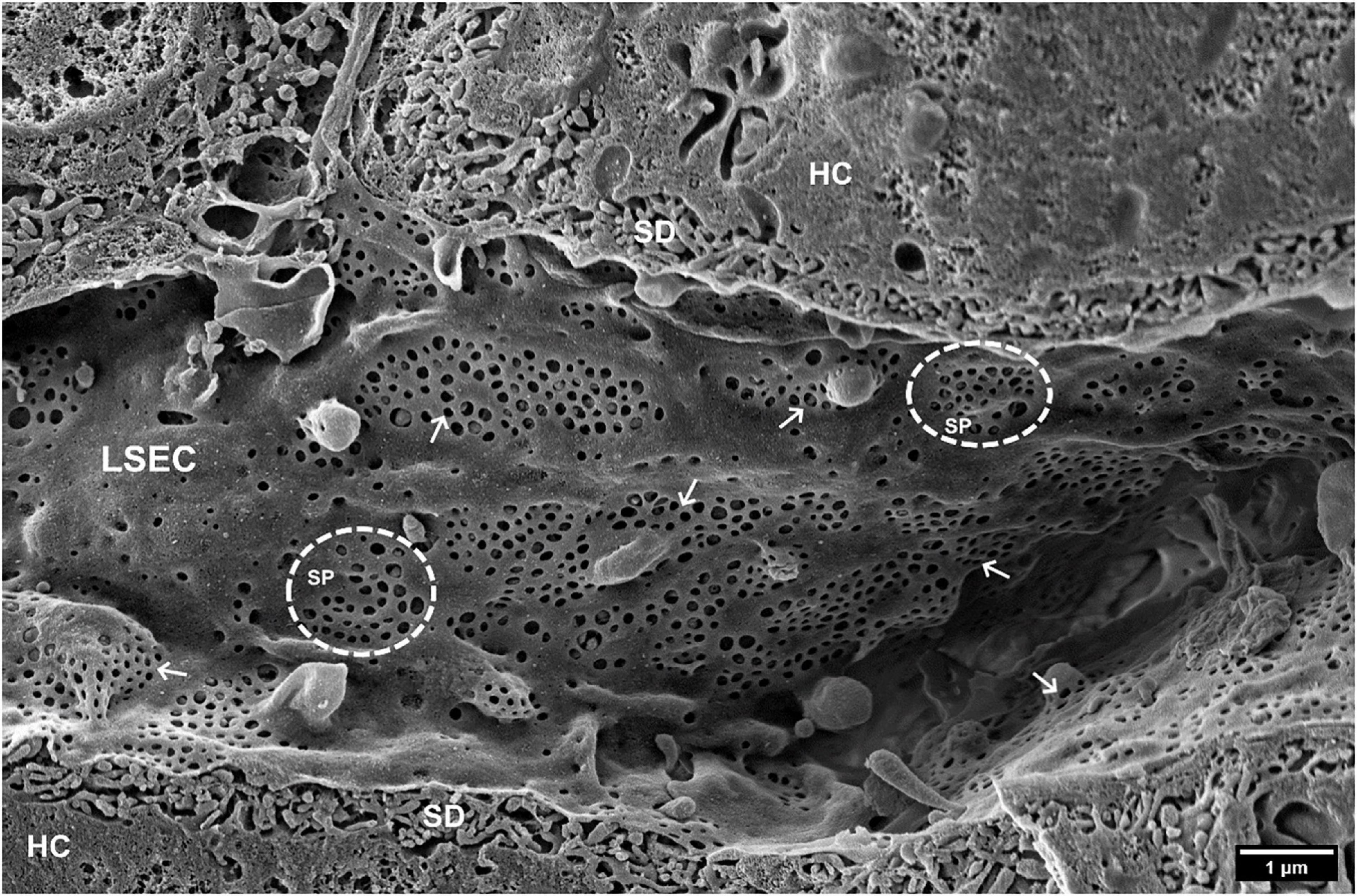 Famous Queen track rocks insulin cells into action