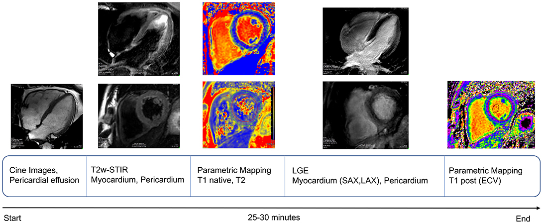 T2 Relaxation Times at Cardiac MRI in Healthy Adults: A Systematic