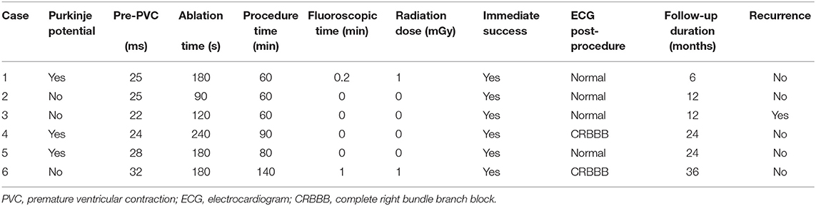 Compartmentalized Structure of the Moderator Band Provides a