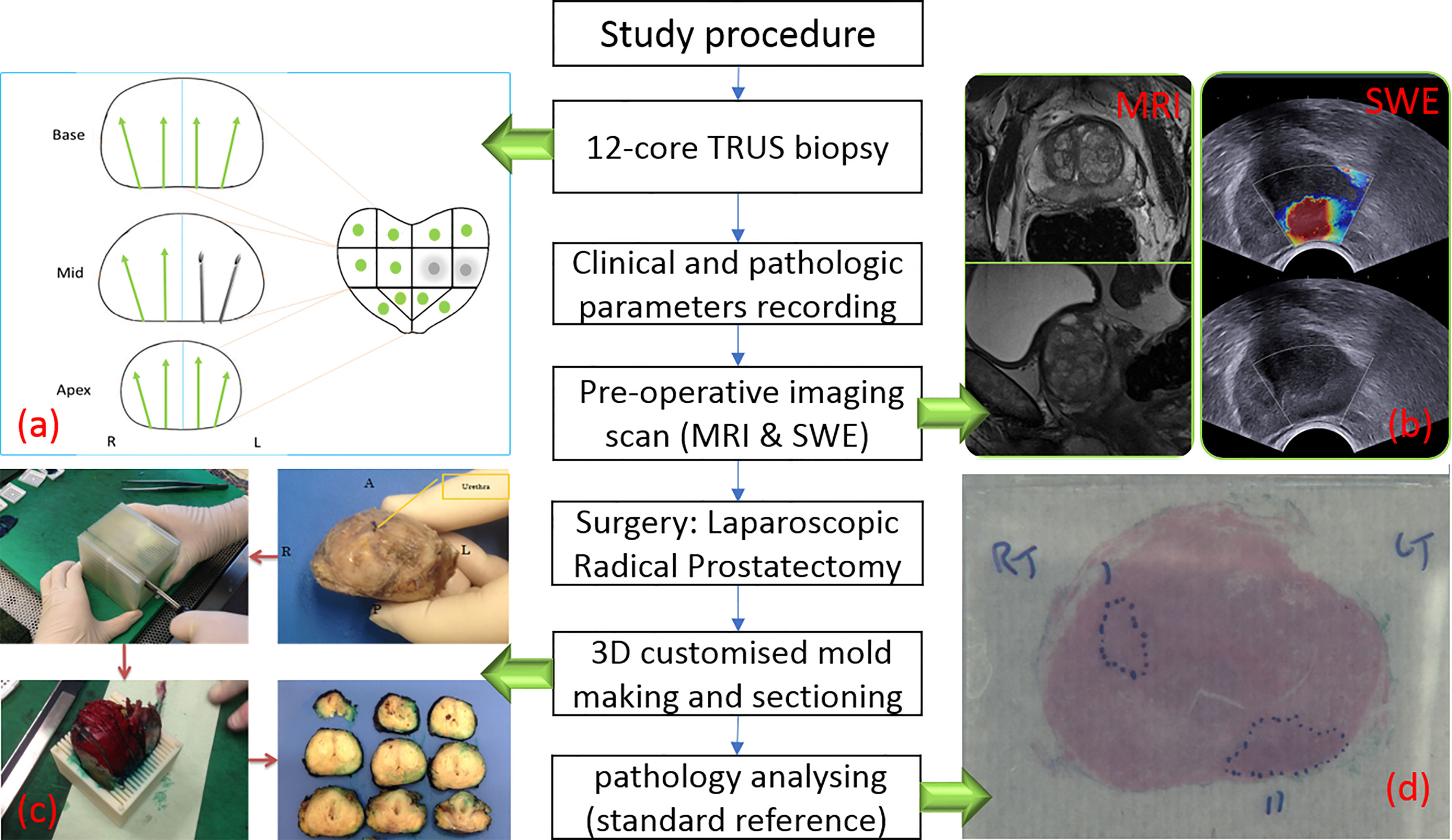 Frontiers  Multiparametric magnetic resonance imaging-derived