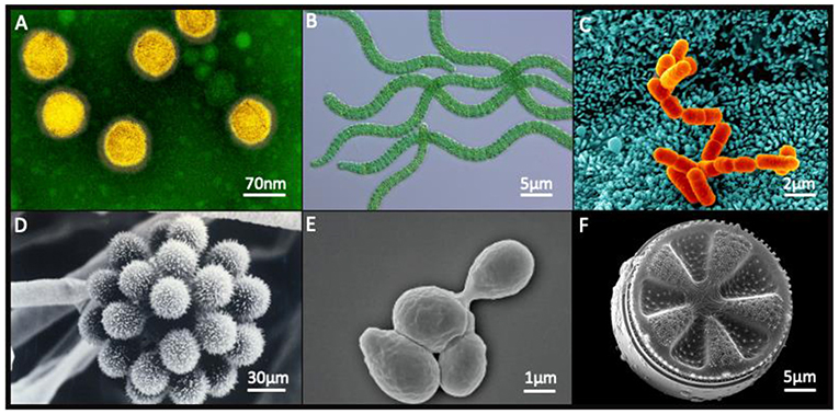 图1 -微生物的例子:(A)病毒,(B)蓝藻、细菌(C), (D)真菌、酵母(E), (F)微藻。