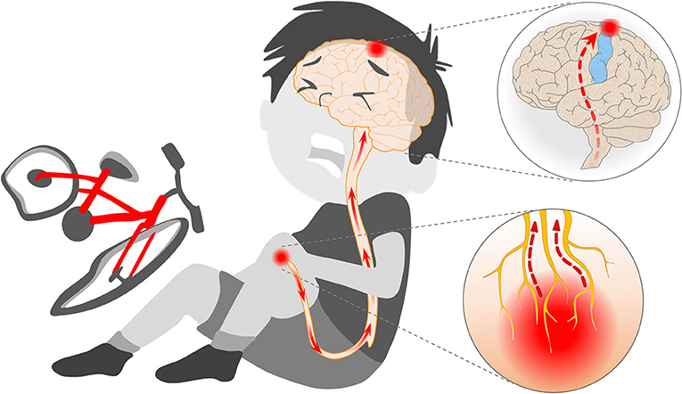 Figure 1 - When you fall off your bike and scrape your knee, strong forces and torn skin cause the endings of nerve fibers in the skin (yellow branches in the red cloud) to generate a flow of electrical pulses (red arrows).