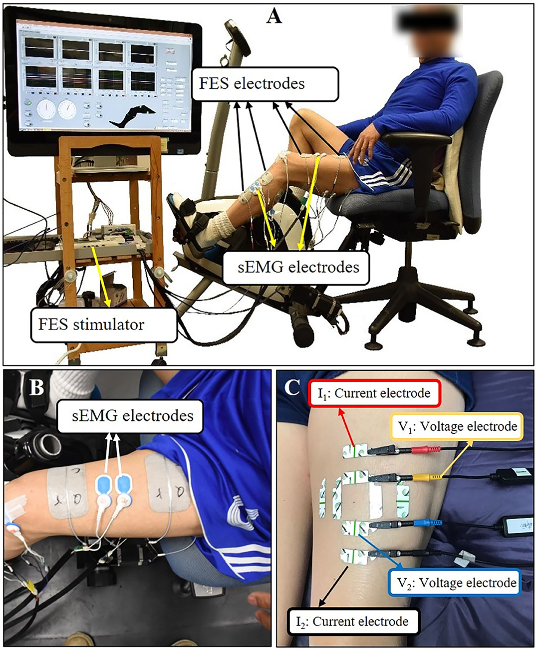 Electrical Muscle Stimulation, United States - OSR Physical Therapy